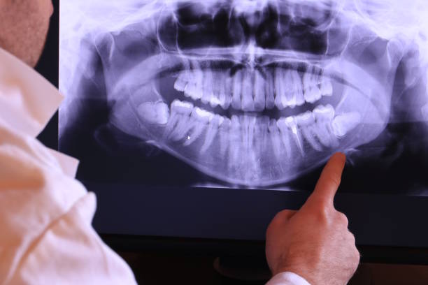 Best Emergency Root Canal Treatment in Riverside, CT